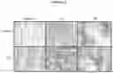 Fig. 09 - Method for diagnosis, prognosis and determination of treatment for cutaneous t-cell lymphoma