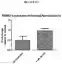 Fig. 11 - Method for diagnosis, prognosis and determination of treatment for cutaneous t-cell lymphoma