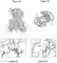 Fig. 08 - SCREENING METHODS