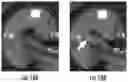 Fig. 19 - MRI RF coil assemblies with RF coil elements that allow wireless communication data transmission and related methods and systems