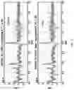 Fig. 06 - Methods for Pre-processing Magnetic Resonance 2-D Correlation Spectroscopy (COSY) Signals to Enhance Data Quality