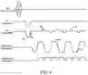 Fig. 05 - System and method for Z-shim compensated echo-planar magnetic resonance imaging