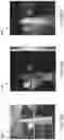 Fig. 25 - Time-resolving image sensor for range measurement and 2D greyscale imaging