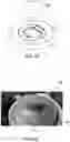 Fig. 14 - Imaging systems with micro optical element arrays and methods of specimen imaging