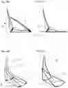 Fig. 08 - Eyeglasses