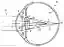 Fig. 01 - Multifocal lens having an optical add power progression, and a system and method of providing same