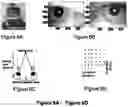 Fig. 08 - Adaptive harmonic diffractive liquid crystal lens and method of making and use thereof