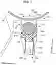 Fig. 02 - Photosensitive drum unit to address vibration of a charge roller