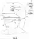 Fig. 04 - Thermal management system for electronic device