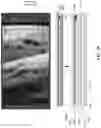Fig. 34 - Under-screen optical fingerprint sensor based on optical imaging with an optical axis off-normal to the display screen surface