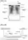 Fig. 04 - Dynamic image analysis apparatus, dynamic image analysis method, and recording medium