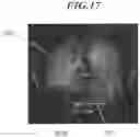 Fig. 17 - Dynamic image analysis apparatus, dynamic image analysis method, and recording medium