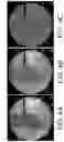 Fig. 05 - Imaging system and method for image localization of effecters during a medical procedure
