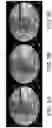 Fig. 06 - Imaging system and method for image localization of effecters during a medical procedure