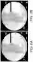 Fig. 07 - Imaging system and method for image localization of effecters during a medical procedure