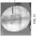Fig. 11 - Imaging system and method for image localization of effecters during a medical procedure