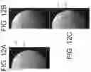 Fig. 12 - Imaging system and method for image localization of effecters during a medical procedure
