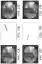 Fig. 13 - Imaging system and method for image localization of effecters during a medical procedure