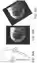 Fig. 16 - Imaging system and method for image localization of effecters during a medical procedure