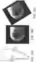 Fig. 18 - Imaging system and method for image localization of effecters during a medical procedure
