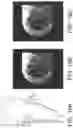 Fig. 19 - Imaging system and method for image localization of effecters during a medical procedure