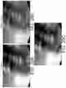 Fig. 25 - Imaging system and method for image localization of effecters during a medical procedure