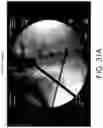 Fig. 27 - Imaging system and method for image localization of effecters during a medical procedure