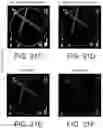 Fig. 29 - Imaging system and method for image localization of effecters during a medical procedure