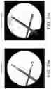 Fig. 31 - Imaging system and method for image localization of effecters during a medical procedure