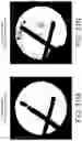 Fig. 32 - Imaging system and method for image localization of effecters during a medical procedure
