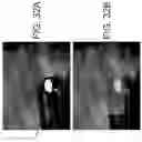 Fig. 34 - Imaging system and method for image localization of effecters during a medical procedure