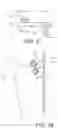 Fig. 45 - Imaging system and method for image localization of effecters during a medical procedure