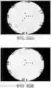 Fig. 68 - Imaging system and method for image localization of effecters during a medical procedure
