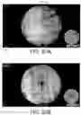 Fig. 69 - Imaging system and method for image localization of effecters during a medical procedure