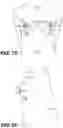 Fig. 32 - System and method of analyzing features of the human face and breasts using one or more overlay grids