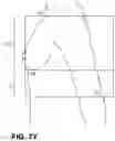Fig. 37 - System and method of analyzing features of the human face and breasts using one or more overlay grids