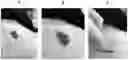 Fig. 01 - Instructional dermatology surface models and methods of use
