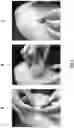 Fig. 04 - Instructional dermatology surface models and methods of use