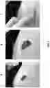 Fig. 05 - Instructional dermatology surface models and methods of use