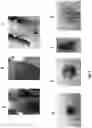 Fig. 07 - Instructional dermatology surface models and methods of use