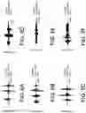 Fig. 08 - Mitigating anomalous sounds