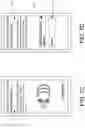 Fig. 11 - Removal of audio noise
