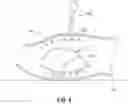 Fig. 05 - Systems and methods for providing assistance during surgery
