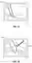 Fig. 11 - Systems and methods for providing assistance during surgery