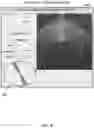 Fig. 09 - System and method for AI-based eye condition determinations