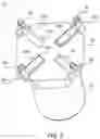 Fig. 04 - Compliant pin structure for discrete electrical components