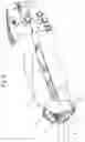Fig. 03 - Hand-actuatable plier tool
