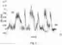 Fig. 07 - Audio distortion compensation