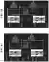 Fig. 05 - IMAGE PICKUP APPARATUS CORRECTING IN-FOCUS POSITION DETECTED BY  AUTO-FOCUSING MECHANISM, FOCUS DETECTION METHOD, AND STORAGE MEDIUM  STORING FOCUS DETECTION PROGRAM