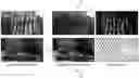 Fig. 01 - Taking photos through visual obstructions